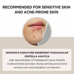 SKIN1004 Madagascar Centella Asiatica Ampoule Facial Serum 1.85 fl.oz, 55ml