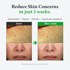 Dr.Althea Gentle Vitamin C Serum | Benefits Skin Tone and Pigmentation