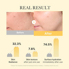 medicube Kojic Acid Turmeric Brightening Gold Jelly Gel Mask | 28g x 4ea