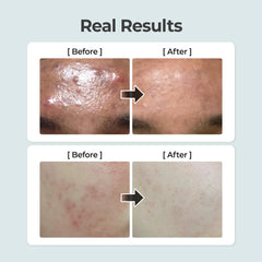 numbuzin No.1 Toner | Pure-Full Calming Herb Toner | 10.14 fl. oz.