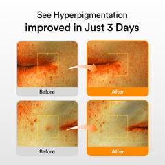 Abib Glutathiosome dark spot serum Vita drop 1.69 fl.oz.