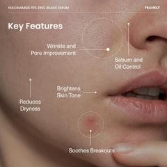 FRANKLY Niacinamide 15% & Zinc Beads 1.2% Serum: Acne & Dark Spots Care | 1.01 fl.oz