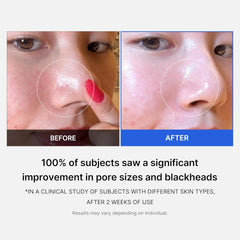 Medicube Zero Pore Pads 2.0, Dual-Textured Facial Toner Pads  (70 Pads)