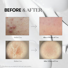 VT COSMETICS CICA Reedle Shot 700, 1Fl Oz (30ml)