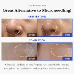 Medicube Zero Exosome Shot 2,000 PPM Spicule Facial Serum 1.01 fl.oz