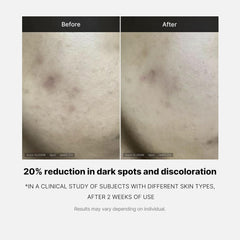 Medicube Deep Vita C Serum 2.0 - 14.5% Pure Vitamin C