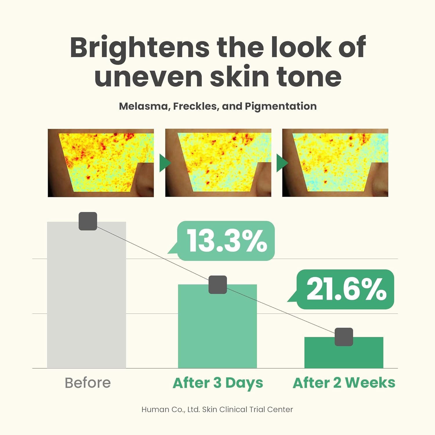 AXIS-Y Dark Spot Correcting Glow Serum - 5% Niacinamide  Vegan  for All Skin Types - 1.69 fl. oz.